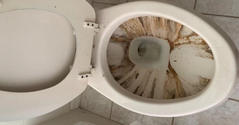 Clean Calcium Build Up In Toilet